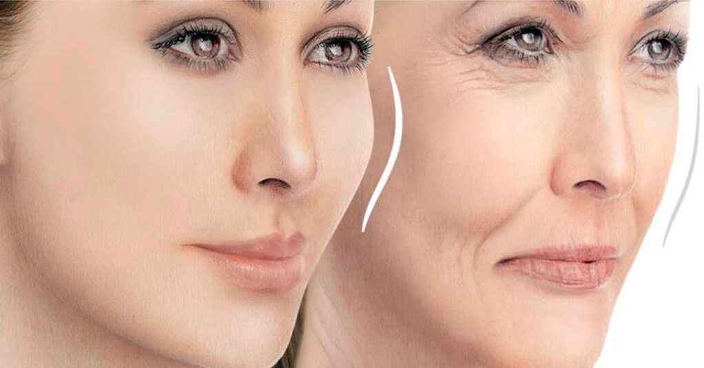 إعادة الحكم