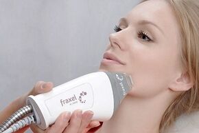 جوهر إجراءات تجديد بشرة الوجه الجزئية